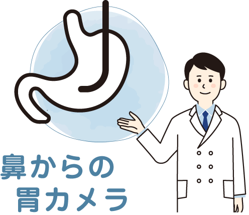 鼻からの胃カメラ