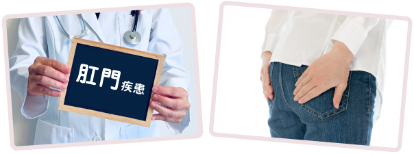 肛門疾患